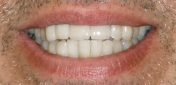 after dental work photo