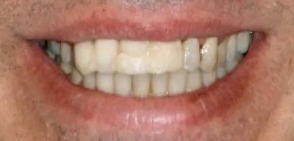 before dental work photo