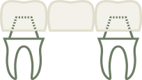 dental bridges icon